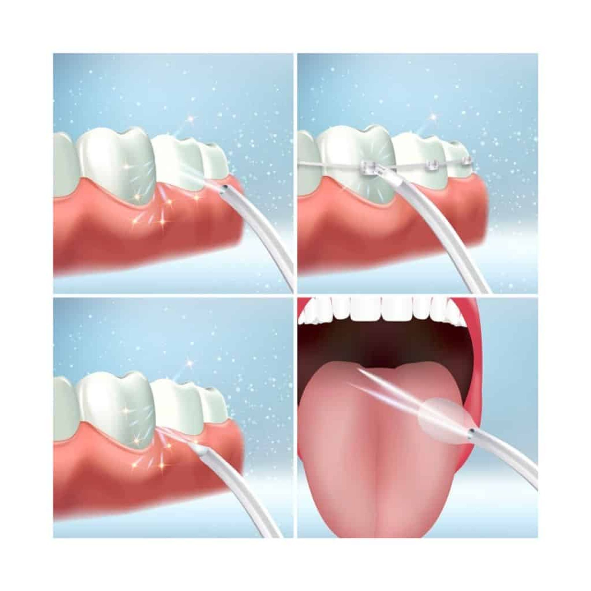 Idropulsore Dentale - Ricaricabile - Portatile